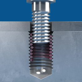 HELICOIL® Tangfree Screwlock – Tang-free screwlocking thread insert for metals