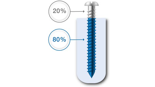 The 80/20 principle of manufacturing costs – 20% part price offset by 80% system costs