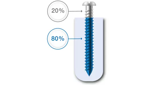 The 80/20 principle of manufacturing costs – 20% part price offset by 80% system costs